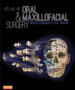 Ebook Atlas of Oral and Maxillofacial Surgery, 1e 1st Edition