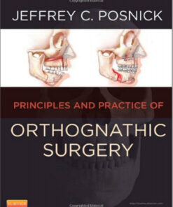 Ebook  Orthognathic Surgery - 2 Volume Set: Principles and Practice, 1e