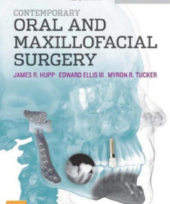 Ebook  Contemporary Oral and Maxillofacial Surgery, 6e 6th Edition