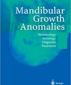 Ebook  Mandibular Growth Anomalies: Terminology - Aetiology Diagnosis - Treatment