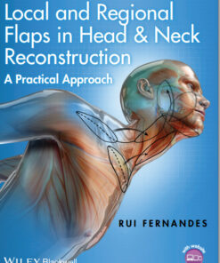 Local and Regional Flaps in Head and Neck Reconstruction: A Practical Approach 1st Edition