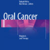 Ebook  Oral Cancer: Diagnosis and Therapy 2015th Edition