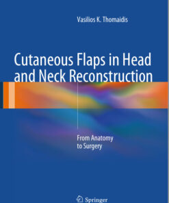 Ebook  Cutaneous Flaps in Head and Neck Reconstruction: From Anatomy to Surgery 2014th Edition
