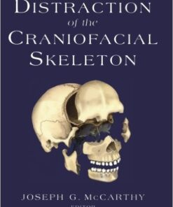 Ebook  Distraction of the Craniofacial Skeleton