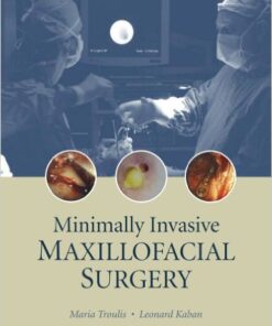 Ebook  Minimally Invasive Maxillofacial Surgery 1st Edition