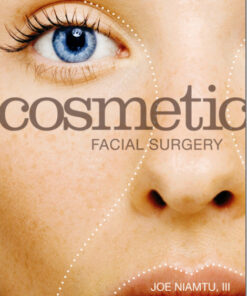 Ebook  Cosmetic Facial Surgery, 1e
