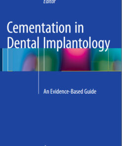 Ebook Cementation in Dental Implantology: An Evidence-Based Guide 2015th Edition