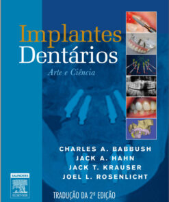 Ebook Implantes Dentários. Arte e Ciência