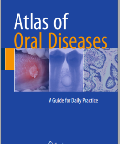 Ebook Atlas of Oral Diseases: A Guide for Daily Practice 1st ed. 2016 Edition