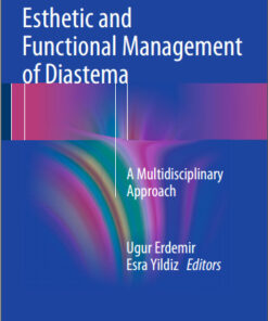 Ebook Esthetic and Functional Management of Diastema: A Multidisciplinary Approach 1st ed. 2016 Edition