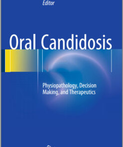 Oral Candidosis: Physiopathology, Decision Making, and Therapeutics 2015 Edition