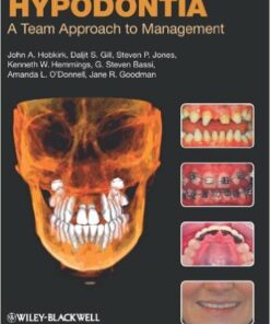 Hypodontia: A Team Approach to Management 1st Edition