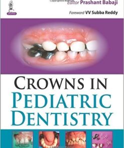 Crowns in Pediatric Dentistry 1st Edition