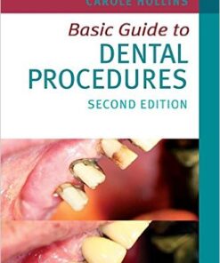 Basic Guide to Dental Procedures  2nd Edition