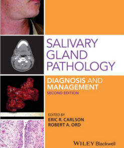 Salivary Gland Pathology: Diagnosis and Management 2nd Edition