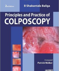 Principles and Practice of Colposcopy 2nd Edition