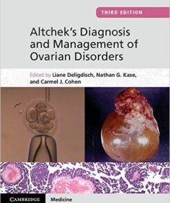 Altchek's Diagnosis and Management of Ovarian Disorders 3rd Edition