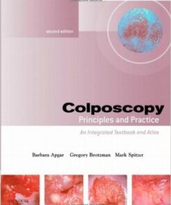 Colposcopy: Principles and Practice, Text  2e (Apgar,Colposcopy: Principles and Practice) 2nd Edition