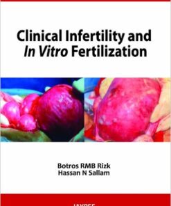 Clinical Infertility and in Vitro Fertilization 1st Edition