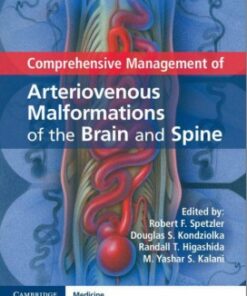 Comprehensive Management of Arteriovenous Malformations of the Brain and Spine