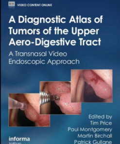 A Diagnostic Atlas of Tumors of the Upper Aero-Digestive Tract: A Transnasal Video Endoscopic Approach