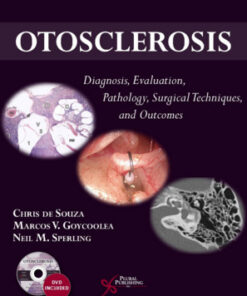 Otosclerosis: Diagnosis, Evaluation, Pathology, Surgical Techniques, and Outcomes