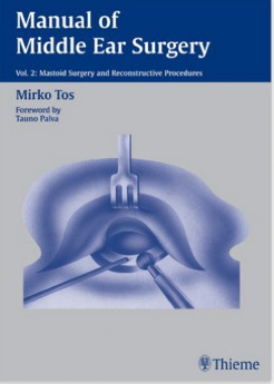Manual ofMiddle Ear Surgery, Volume 2 (Manual of Middle Ear Surgery)