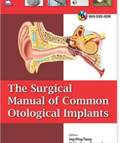 The Surgical Manual of Common Otological Implants