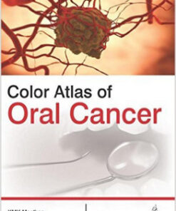 Free Color Atlas of Oral Cancer 1st Edition