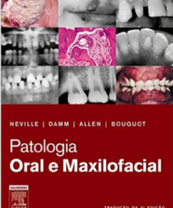 Patologia Oral E Maxilofacial (Em Portuguese do Brasil) (Portuguese Brazilian)