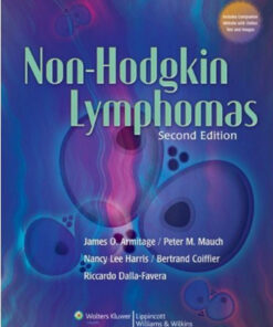 Non-Hodgkin Lymphomas Second Edition