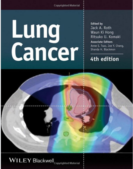 Lung Cancer 4th Edition