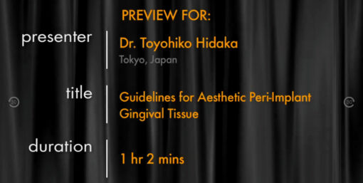 Guidelines for Aesthetic Peri-Implant Gingival Tissue (JAPANESE LANGUAGE ONLY)