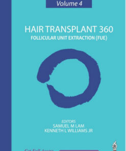 Hair Transplant 360: Follicular Unit Extraction - Volume 4