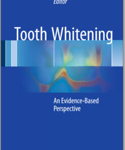 Tooth Whitening: An Evidence-Based Perspective 1st ed. 2016 Edition