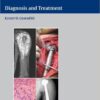 Orthopaedic Oncology: Diagnosis and Treatment