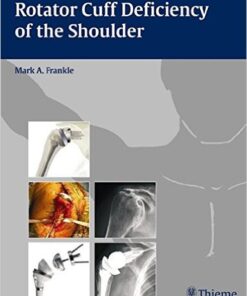 Rotator Cuff Deficiency of the Shoulder 1st Edition