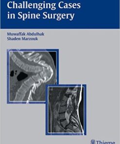 Challenging Cases in Spine Surgery 1st Edition