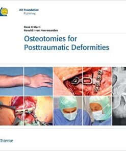 Osteotomies for Posttraumatic Deformities  1st Edition