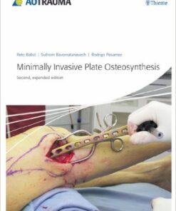 Minimally Invasive Plate Osteosynthesis Kindle Edition