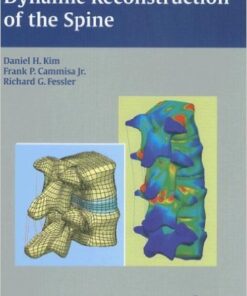 Dynamic Reconstruction of the Spine 1st Edition