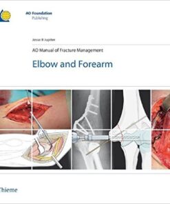AO Manual of Fracture Management: Elbow & Forearm 1st Edition