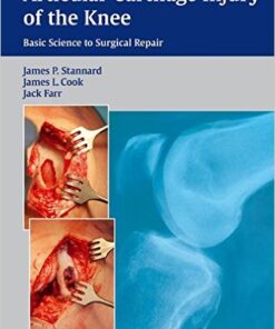 Articular Cartilage Injury of the Knee: Basic Science to Surgical Repair 1st Edition