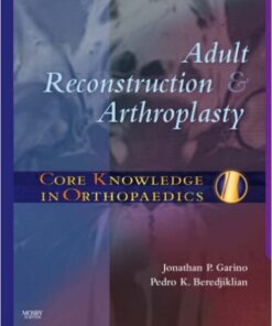 Core Knowledge in Orthopaedics: Adult Reconstruction and Arthroplasty, 1e 1st Edition