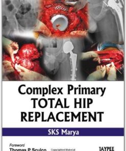Complex Primary Total Hip Replacement 1st Edition