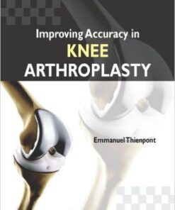 Improving Accuracy in Knee Arthroplasty 1st Edition