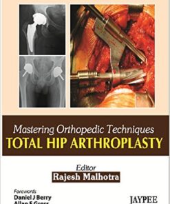Mastering Orthopedic Techniques Total Hip Arthroplasty Kindle Edition