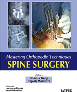 Mastering Orthopedic Techniques Spine Surgery Kindle Edition
