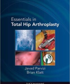 Essentials in Total Hip Arthroplasty 1st Edition