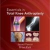 Essentials in Total Knee Arthroplasty 1st Edition